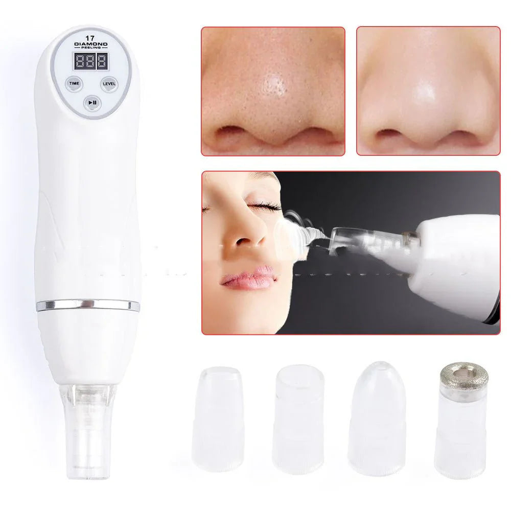 Electric Pore Suction and Acne Removing Device Beauty Cleanerجهاز شفط المسام الكهربائي وإزالة حب الشباب – منظف تجميلي